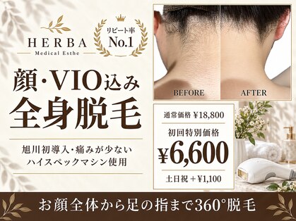 ヘルバ(HERBA)の写真