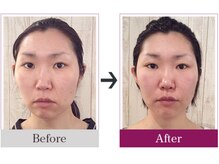 ビコツゼロ 青山(BIKOTSU ZERO)の雰囲気（顎・顔の歪みは本来の状態に整えると見た目の印象がUPします！）