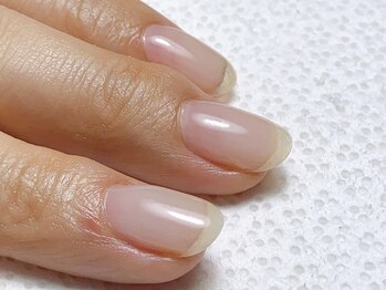 キアラネイル(Chiala nail)の写真/【自爪育成・深爪矯正・ジェル育成】3か月8回施術コースで縦長な美爪へ導きます♪継続ケアで爪を修繕&強化!