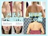ブライダルケア花嫁様応援！バスト二の腕肩甲骨フェイスライントータルケア