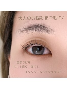 ウチニィ(uchiny)/エクソソームで月1サロンケア