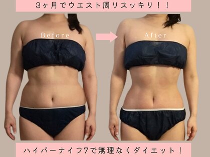 ミラ 札幌店(Mira)の写真
