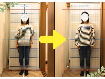 ぎふと整体院/Befor&After