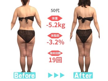 ビースタイル 多治見店(B'style)/40代マイナス4キロ