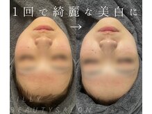 リリー(LILLY)の雰囲気（確実な肌質改善と小顔改善をご提供いたします。）