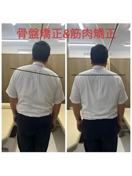 きむら整骨院 鍼灸院の写真/その痛みや凝り・不調…もしかしたら歪みから！？