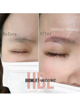 アマリリス(Amaryllis)/ハリウッドブロウリフト(HBL)