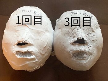 パール/石膏パックのビフォーアフター