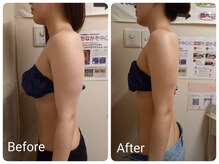 スマイルボディ つぼの森 加治木店(Smile body)/ブライダルエステ　