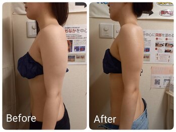 スマイルボディ つぼの森 加治木店(Smile body)/ブライダルエステ　