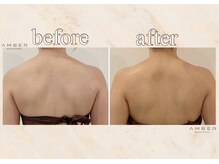 アンバー 恵比寿(AMBER)/背中を綺麗に見せたい