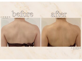 アンバー 恵比寿(AMBER)/背中を綺麗に見せたい