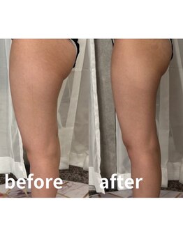 ドクターエイジレス(DR.AGELESS)/美尻、美脚、美背中、美くびれ!