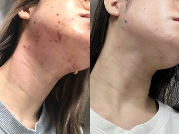 ヨサパーク リワード 本八幡駅前店(YOSA PARK Reward)/ファンデ卒業！美肌にも効果的◎