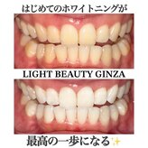 ライトビューティー 銀座店(LightBeauty)