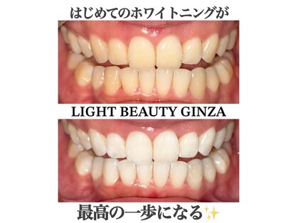 ライトビューティー 銀座店(LightBeauty)の写真