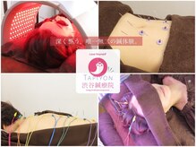 タピヨン 渋谷鍼療院(Tapiyon)