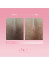 グラッソ(GRASSO)/ララピンク