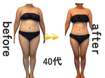 ジュリアン(Julien)/【お客様結果写真】[麹町/痩身]