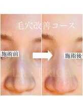 ラピリカ(LA PRICA)/