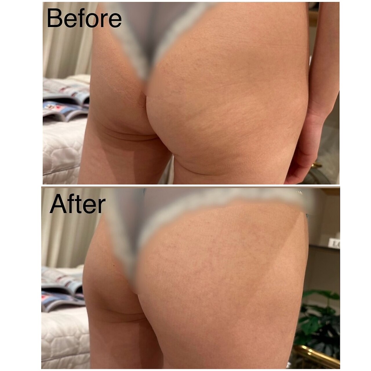 麻布十番駅でエンダモロジーが人気のエステサロン｜ホットペッパー