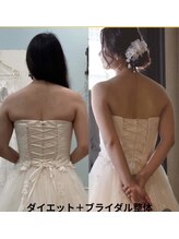 リセット(RESET)/佐世保ブライダルダイエット