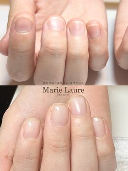 マリーロール 梅田店(Marie Laure)/自爪育成/深爪矯正/ネイルケア