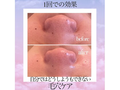 スリーグリッター(3glitter)の写真