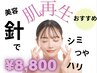 【staff一押し◎】シミケア！マイクロニードルピーリング　14900円→8800円　