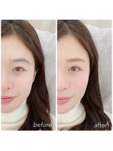 アイル バイ ストーク(I’LL by STOKED)/眉毛WAX＆ラッシュリフト♪