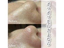 ラエッセ(LAESSE)の雰囲気（気になるお汚れもスッキリ解消！さまざまなメニューをご用意♪）
