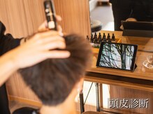 オデラ 小山店(AUDELA)/マイクロスコープ頭皮診断