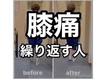 カワル整体 上通り院/膝痛繰り返す人