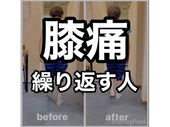 カワル整体 上通り院/膝痛繰り返す人