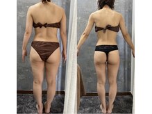 ウィンウィン 新山口店(Win Win)/before→after