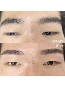 エクレ(EKURE)/メンズアイブロウ/メンズ眉毛