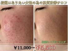 アリュール 倉敷(ALLURE)