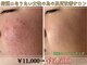 アリュール 倉敷(ALLURE)の写真