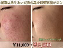 アリュール 倉敷(ALLURE)