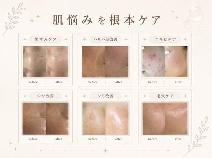 ベルスキン(Bell skin)の写真