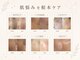 ベルスキン(Bell skin)の写真