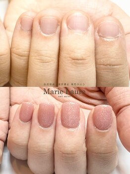 マリーロール 梅田店(Marie Laure)/自爪育成/深爪矯正/ネイルケア