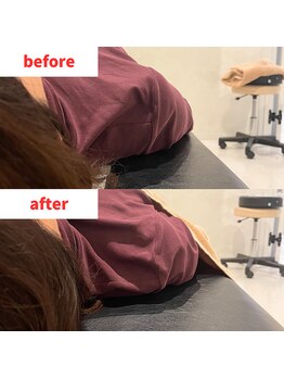 ナオル整体 福岡香椎院(NAORU整体)/50代女性施術事例【巻肩】