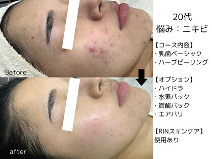 リンフェイス 表参道(RIN FACE)の写真