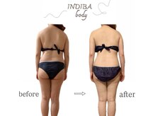 インディバ ベース(INDIBA BASE)の雰囲気（血行と代謝UPで冷え・むくみ・肩こりなど体の不調を根本からケア）