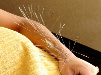 泰然の写真/姫路で希少なルート鍼施術◆どこに行っても改善されなかったコリ/痛み/疲れに圧倒的な効果実感◎