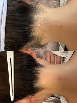 サイウン 辻堂駅前(saiun)/うなじケアの新習慣