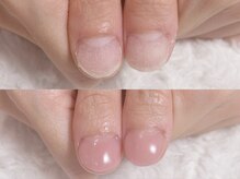 グラシナ なんば店/即日長さだしスキンカラー仕上げ