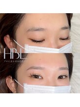 ベティーブロー(Betty Brow)/新ハリウッドブロウリフト