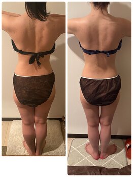 フーガ 宇都宮店(fu-ga)/やみつき 美骨リンパマッサージ